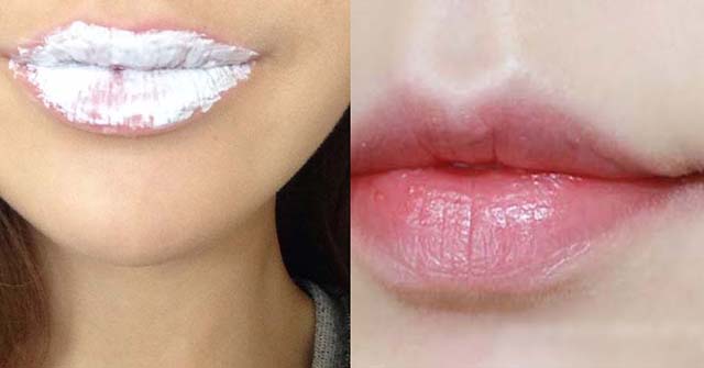 Cách trị thâm môi bằng kem đánh răng