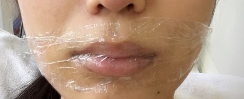 Cách ủ tê cho môi