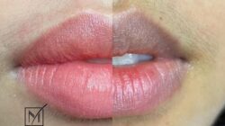 Có nhiều cách xử lý khi phun môi bị lệch viền.